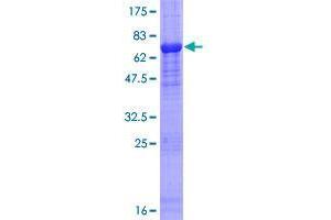 Image no. 1 for F-Box Protein 31 (FBXO31) (AA 1-367) protein (GST tag) (ABIN1353803) (FBXO31 Protein (AA 1-367) (GST tag))