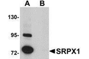 Western Blotting (WB) image for anti-Sushi-Repeat Containing Protein, X-Linked (SRPX) (N-Term) antibody (ABIN2476576)