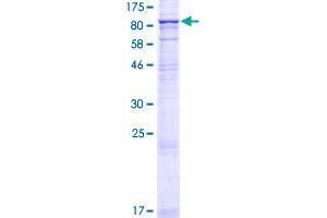 STRA6 Protein (AA 1-667) (GST tag)