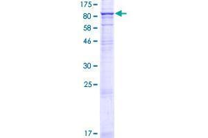 Image no. 1 for Stimulated By Retinoic Acid 6 (STRA6) (AA 1-667) protein (GST tag) (ABIN1321740) (STRA6 Protein (AA 1-667) (GST tag))