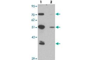 Western blot analysis of TMPO in HeLa cell lysate with TMPO polyclonal antibody  at 0. (Thymopoietin antibody  (N-Term))