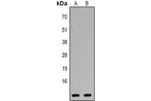 Western blot analysis of CXCL1 expression in Jurkat (A), Hela (B) whole cell lysates.