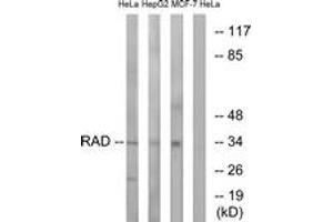 Western Blotting (WB) image for anti-Ras-Related Associated with Diabetes (RRAD) (AA 41-90) antibody (ABIN2890366) (RRAD antibody  (AA 41-90))