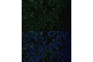 Immunofluorescence analysis of NIH-3T3 cells using  antibody (ABIN6131426, ABIN6136765, ABIN6136766 and ABIN6223405) at dilution of 1:100. (ALDH1A2 antibody  (AA 1-180))