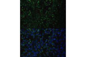 Immunofluorescence analysis of NIH-3T3 cells using  antibody (ABIN6131426, ABIN6136765, ABIN6136766 and ABIN6223405) at dilution of 1:100. (ALDH1A2 antibody  (AA 1-180))