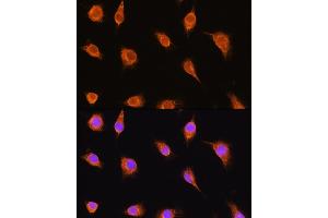 Immunofluorescence (IF) image for anti-Sarcoglycan, alpha (50kDa Dystrophin-Associated Glycoprotein) (SGCA) (AA 60-290) antibody (ABIN1682687)