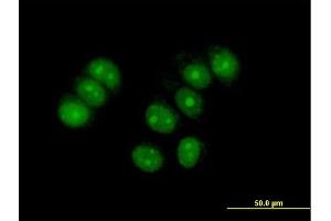 Immunofluorescence of purified MaxPab antibody to ZNF554 on MCF-7 cell. (ZNF554 antibody  (AA 1-538))