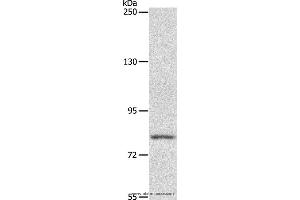 Western blot analysis of Mouse liver tissue, using ABCB6 Polyclonal Antibody at dilution of 1:250 (ABCB6 antibody)
