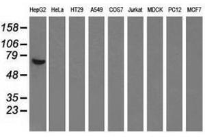 Image no. 4 for anti-alpha-Fetoprotein (AFP) antibody (ABIN1496486) (alpha Fetoprotein antibody)