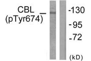 Western blot analysis of extracts from HepG2 cells treated with Na2VO3 0. (CBL antibody  (pTyr674))