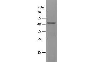 CHST15 Protein (AA 330-561) (His-IF2DI Tag)