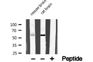 Western blot analysis of extracts of various tissue sample,using SKIL Antibody . (SKIL antibody  (C-Term))