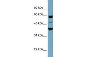 Image no. 1 for anti-SEC22 Vesicle Trafficking Protein Homolog C (SEC22C) (AA 179-228) antibody (ABIN6741920) (SEC22C antibody  (AA 179-228))