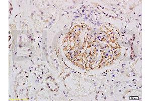 Formalin-fixed and human kidney tissue labeled with Anti-ESM1 Polyclonal Antibody, Unconjugated (ABIN701635) at 1:200 followed by conjugation to the secondary antibody and DAB staining (ESM1 antibody  (AA 51-150))