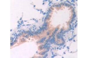 IHC-P analysis of Rat Tissue, with DAB staining. (TPSAB1 antibody  (AA 29-148))