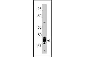 The PRMT6 polyclonal antibody  was used to detect human PRMT6 protein in human brain extract in a Western blot analysis. (PRMT6 antibody  (N-Term))