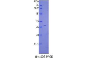 SDS-PAGE analysis of Mouse Cathepsin C Protein.