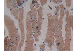 IHC-P analysis of Mouse Skeletal Muscle Tissue, with DAB staining. (MYH2 antibody  (AA 1238-1472))
