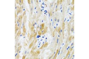 Immunohistochemistry of paraffin-embedded mouse heart using PHPT1 antibody (ABIN3021488, ABIN3021489, ABIN3021490 and ABIN6215139) at dilution of 1:100 (40x lens). (PHPT1 antibody  (AA 1-125))