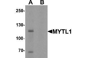 Western Blotting (WB) image for anti-Myelin Transcription Factor 1-Like (MYT1L) (C-Term) antibody (ABIN1077393) (MYT1L antibody  (C-Term))