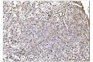 IHC analysis of NDEL1 using anti-NDEL1 antibody (ABIN7602511).