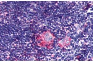 Immunohistochemical (Formalin/PFA-fixed paraffin-embedded sections) staining in human thymus with P2RY5 polyclonal antibody . (LPAR6 antibody  (2nd Extracellular Domain))