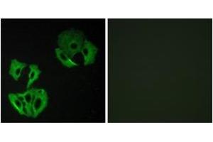 Immunofluorescence analysis of A549 cells, using MADD Antibody. (MADD antibody  (AA 751-800))