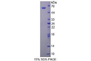 SDS-PAGE analysis of Human ALDH1A1 Protein.