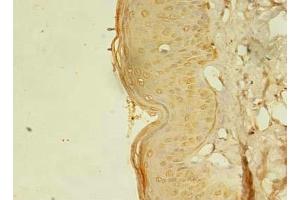 Immunohistochemistry of paraffin-embedded human skin tissue using ABIN7168075 at dilution of 1:100 (RTKN2 antibody  (AA 1-163))