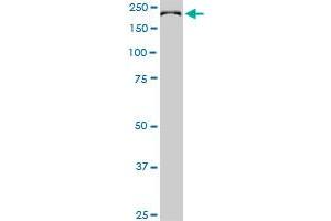 CDC42BPB monoclonal antibody (M03), clone 2F4. (CDC42BPB antibody  (AA 1580-1679))