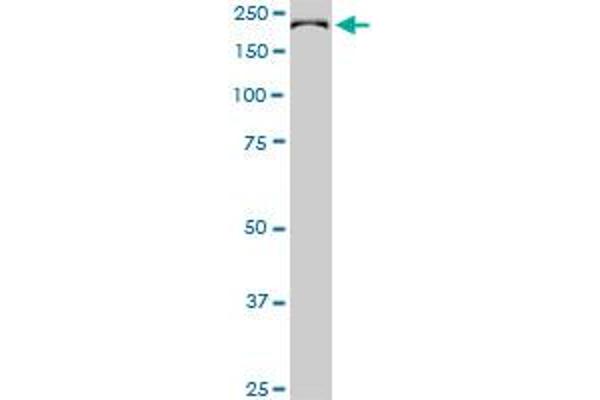 CDC42BPB antibody  (AA 1580-1679)