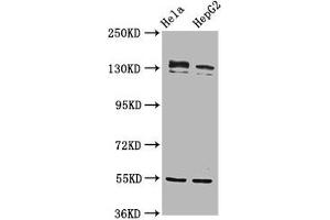 Western Blot Positive WB detected in: Hela whole cell lysate, HepG2 whole cell lysate All lanes: RECQL4 antibody at 4. (RECQL4 antibody  (AA 200-337))