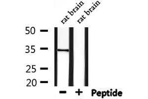 TRADD antibody  (N-Term)