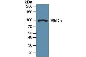 Detection of DNM2 in Mouse Brain Tissue using Polyclonal Antibody to Dynamin 2 (DNM2) (DNM2 antibody  (AA 533-731))