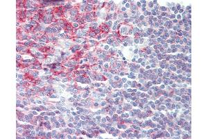 Anti-CD20 antibody IHC staining of human tonsil. (CD20 antibody)