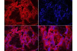 Formalin-fixed and paraffin embedded human placenta labeled with Rabbit Anti-TLR7 Polyclonal Antibody, Unconjugated  DAPI staining (TLR7 antibody  (AA 461-560))