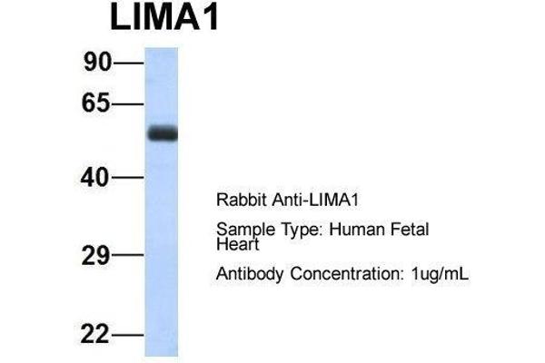 LIMA1 抗体  (N-Term)