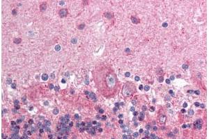Human Brain, Cerebellum (formalin-fixed, paraffin-embedded) stained with NCOR1 antibody ABIN214125 at 5 ug/ml followed by biotinylated goat anti-rabbit IgG secondary antibody ABIN481713, alkaline phosphatase-streptavidin and chromogen. (NCOR1 antibody  (AA 484-533))