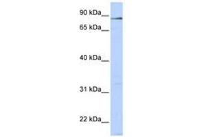 Image no. 1 for anti-L(3)mbt-Like 4 (L3MBTL4) (AA 36-85) antibody (ABIN6740475)