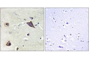 Immunohistochemistry analysis of paraffin-embedded human brain tissue, using NMDAR1 (Ab-896) Antibody. (GRIN1/NMDAR1 antibody  (AA 862-911))