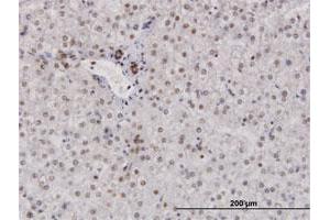 Immunohistochemistry (Formalin-fixed Paraffin-embedded Sections) (IHC (fp)) image for anti-Replication Protein A2, 32kDa (RPA2) (AA 1-270) antibody (ABIN519843)