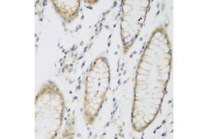 Immunohistochemistry of paraffin-embedded human stomach using NB antibody (ABIN6132989, ABIN6144383, ABIN6144385 and ABIN6223030) at dilution of 1:200 (40x lens). (NAT8B antibody  (AA 75-165))