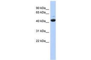 Image no. 1 for anti-ATPase, H+ Transporting, Lysosomal 42kDa, V1 Subunit C1 (ATP6V1C1) (AA 61-110) antibody (ABIN6741468) (ATP6V1C1 antibody  (AA 61-110))