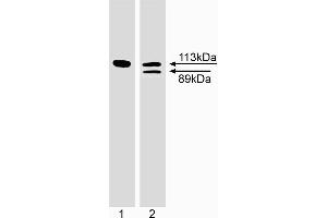 Western blot analysis of PARP cleavage. (PARP1 antibody)