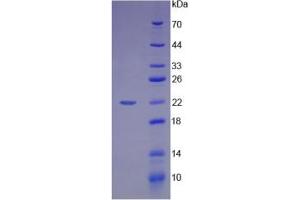 SDS-PAGE (SDS) image for High Mobility Group Box 1 (HMGB1) ELISA Kit (ABIN6574155)