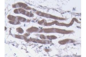 Detection of PLIN1 in Mouse Skin Tissue using Polyclonal Antibody to Perilipin 1 (PLIN1) (PLIN1 antibody  (AA 1-210))