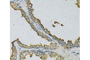 Immunohistochemistry of paraffin-embedded Human prostate using RPLP0 Polyclonal Antibody at dilution of 1:100 (40x lens).
