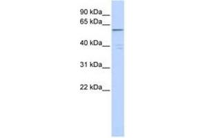 Image no. 1 for anti-Zinc Finger Protein 141 (ZNF141) (C-Term) antibody (ABIN6740540) (ZNF141 antibody  (C-Term))