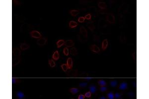 Immunofluorescence analysis of HeLa cells using FLNA Polyclonal Antibody at dilution of 1:100 (40x lens). (Filamin A antibody)