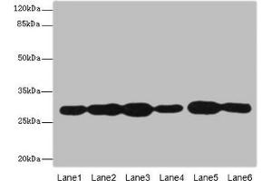 Western blot All lanes: PMM2 antibody at 3. (PMM2 antibody  (AA 1-246))